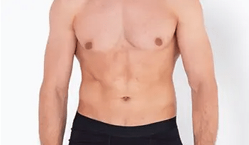 Gynaecomastia | Dr André Safvat - Plastic & Reconstructive Surgery - Bowral, Concord & Miranda